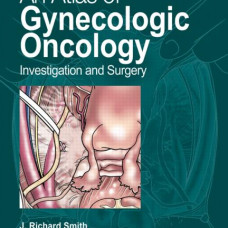 An Atlas of Gynecologic Oncology: Investigation and Surgery