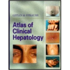 ATLAS OF CLINICAL HEPATOLOGY                          