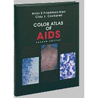 COLOR ATLAS OF AIDS                               