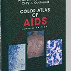 COLOR ATLAS OF AIDS                               
