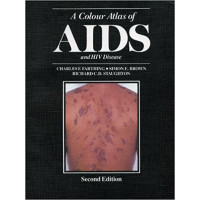 A COLOUR ATLAS OF AIDS AND HIV    DISEASE            