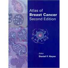 ATLAS OF BREAST CANCER
