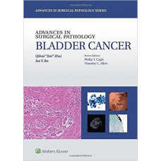 Advances in Surgical Pathology: Bladder Cancer (Advances in Surgical Pathology)