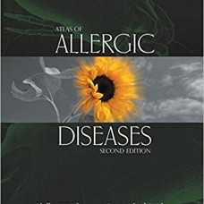 ATLAS OF ALLERGIC DISEASES