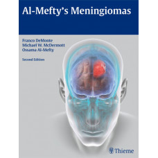 Al-Mefty's Meningiomas: 2/e