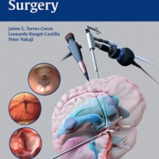 Neuroendoscopic Surgery: 1/e
