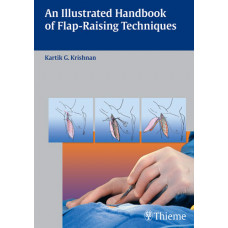 An Illustrated Handbook of Flap-Raising Techniques: 1/e