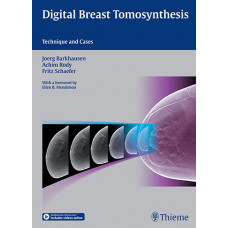 Digital Breast Tomosynthesis: Technique and Cases: 1/e