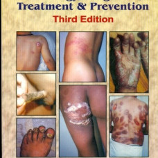 Aids Pathology, Diagnosis, Treatment & Prevention, 3E