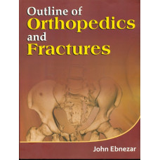 Outline Of Orthopedics And Fractures