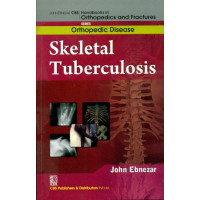 Skeletal Tuberculosis (Handbooks In Orthopedics And Fractures Series, Vol.33: Orthopedic Diseases)