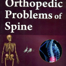 Orthopedic Problems Of Spine (Handbooks In Orthopedics And Fractures Series, Vol.38-Specific Orthopedic Problems)