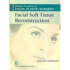 Facial Soft Tissue Reconstruction (Thomas Procedures In Facial Plastic Surgery)- Sie