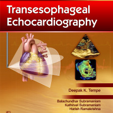 Problem-Based Transesophageal Echocardiography (2013)