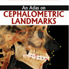An Atlas on Cephalometric Landmarks