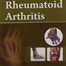Rheumatoid Arthritis (Handbooks In Orthopedics And Fractures Series, Vol. 92-Common Orthopedic Problems   )