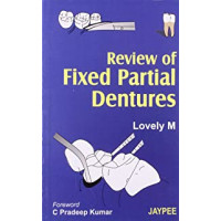 Review of Fixed Partial Dentures