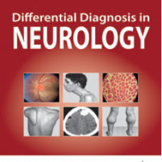 Differential Diagnosis in Neurology