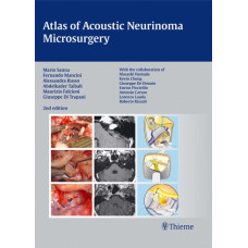 Atlas of Acoustic Neurinoma Microsurgery: 2/e