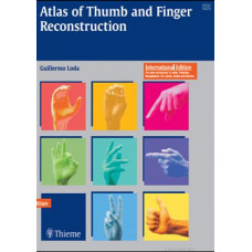 Atlas of Thumb and Finger Reconstruction: Interesting Topics in Hand Surgery: 1/e